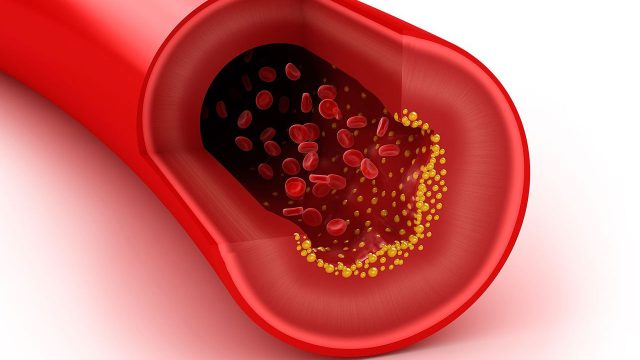Kolesterol dost mu düşman mı?